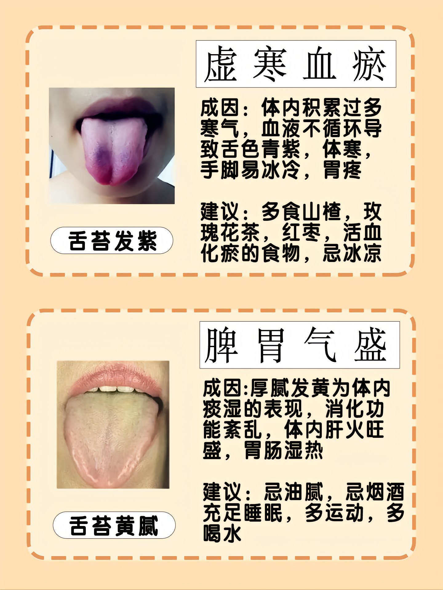 ”观舌象辨健康“第8讲--舌色辨证诊病之淡白舌 - 知乎