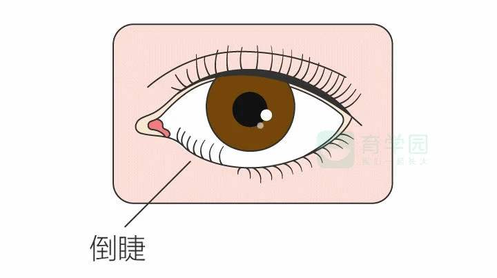 睫毛倒着生长感觉如此酸爽