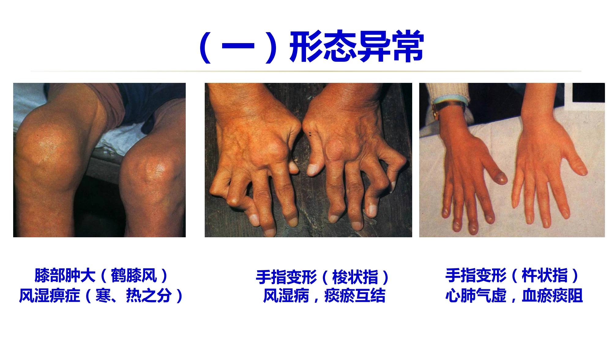 从零开始学中医：望四肢 - 哔哩哔哩