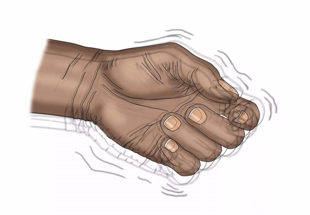 青少年手抖是什么原因?