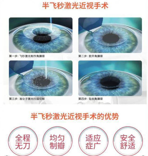 近视矫正手术的最新进展