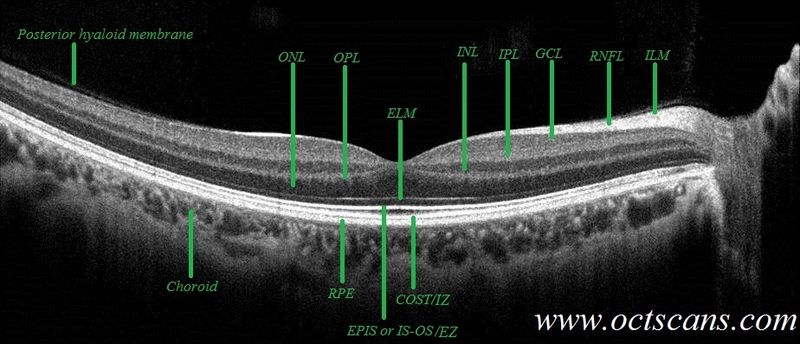 视网膜oct分层图片图片