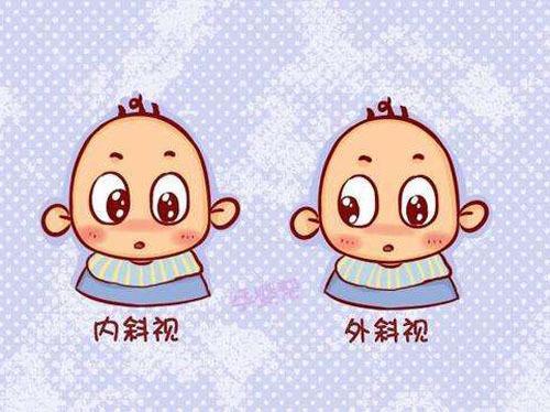 预防孩子斜视的方法有哪些