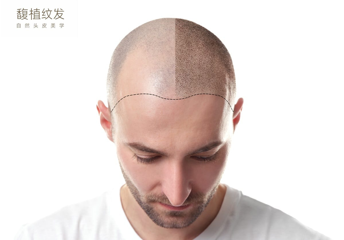 大家一般去哪里纹发？广州纹发，神奇的3D纹发技术 - 知乎