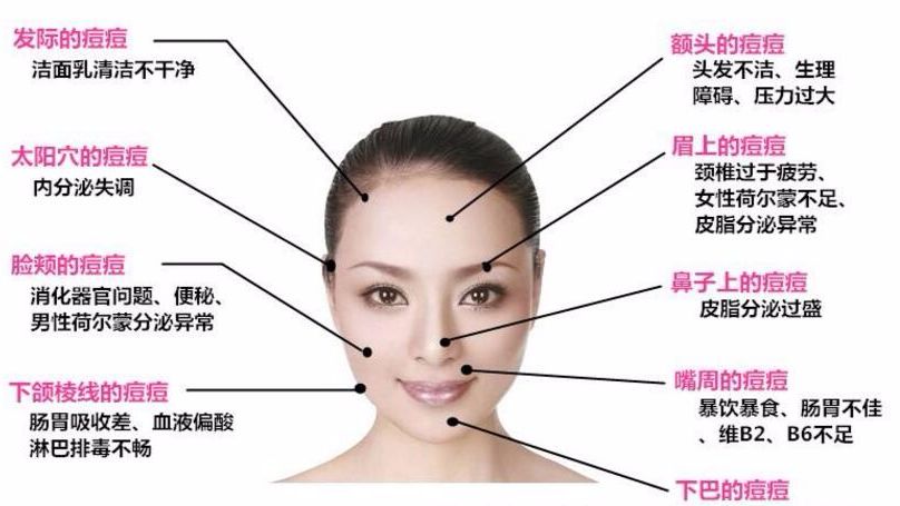 脸上长痘未必是件坏事情 不同位置的痘痘代表你的身体状况 哔哩哔哩