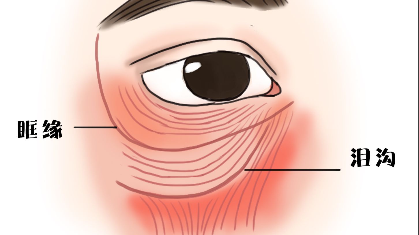 眼周衰老之眼袋与中面部的关系（四） - 知乎