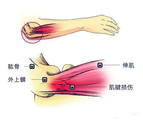 手肘位置图片