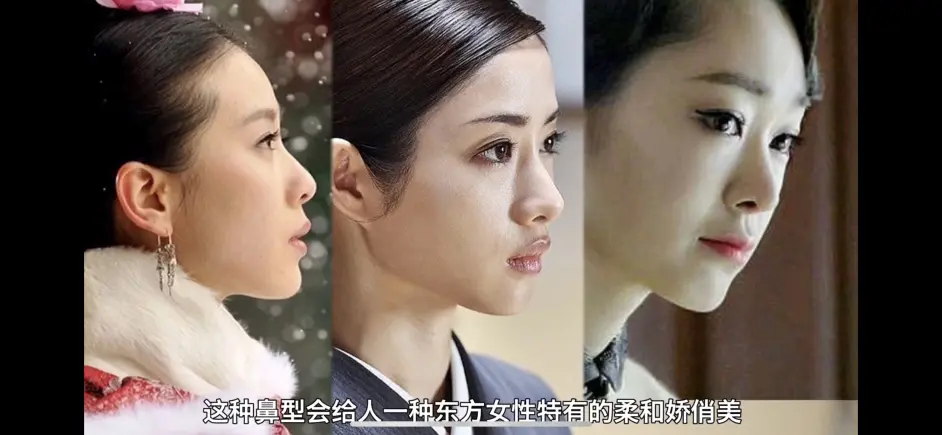 颜值分析 如何拯救一个极丑的鼻子 鼻整形必看 哔哩哔哩