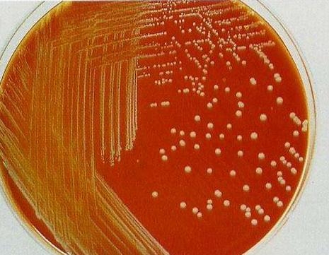 微生物平板划线图片