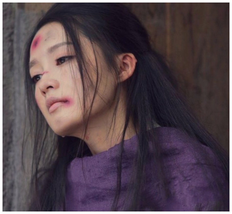 女星受伤吐血:Baby尴尬赵丽颖虐心,她堪称演技