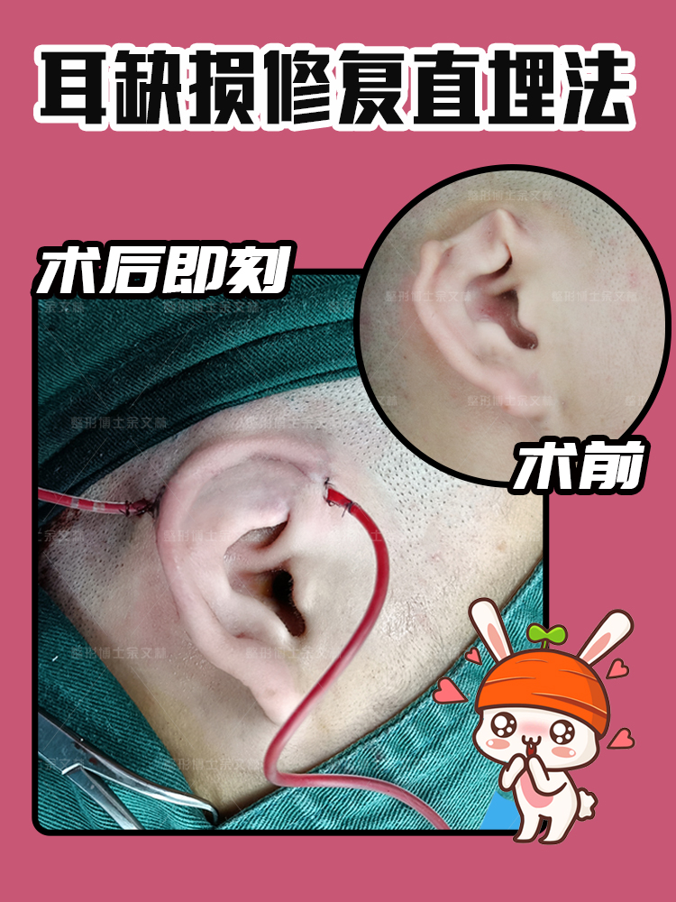 余文林整形博士 粉丝:63文章:640      关注