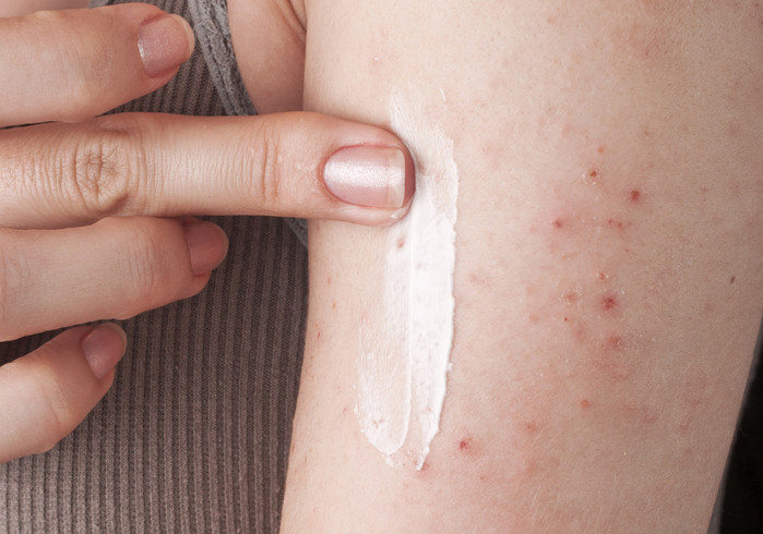 打维C可以治鸡皮肤吗(吃维生素C和维生素B可以去鸡皮肤)