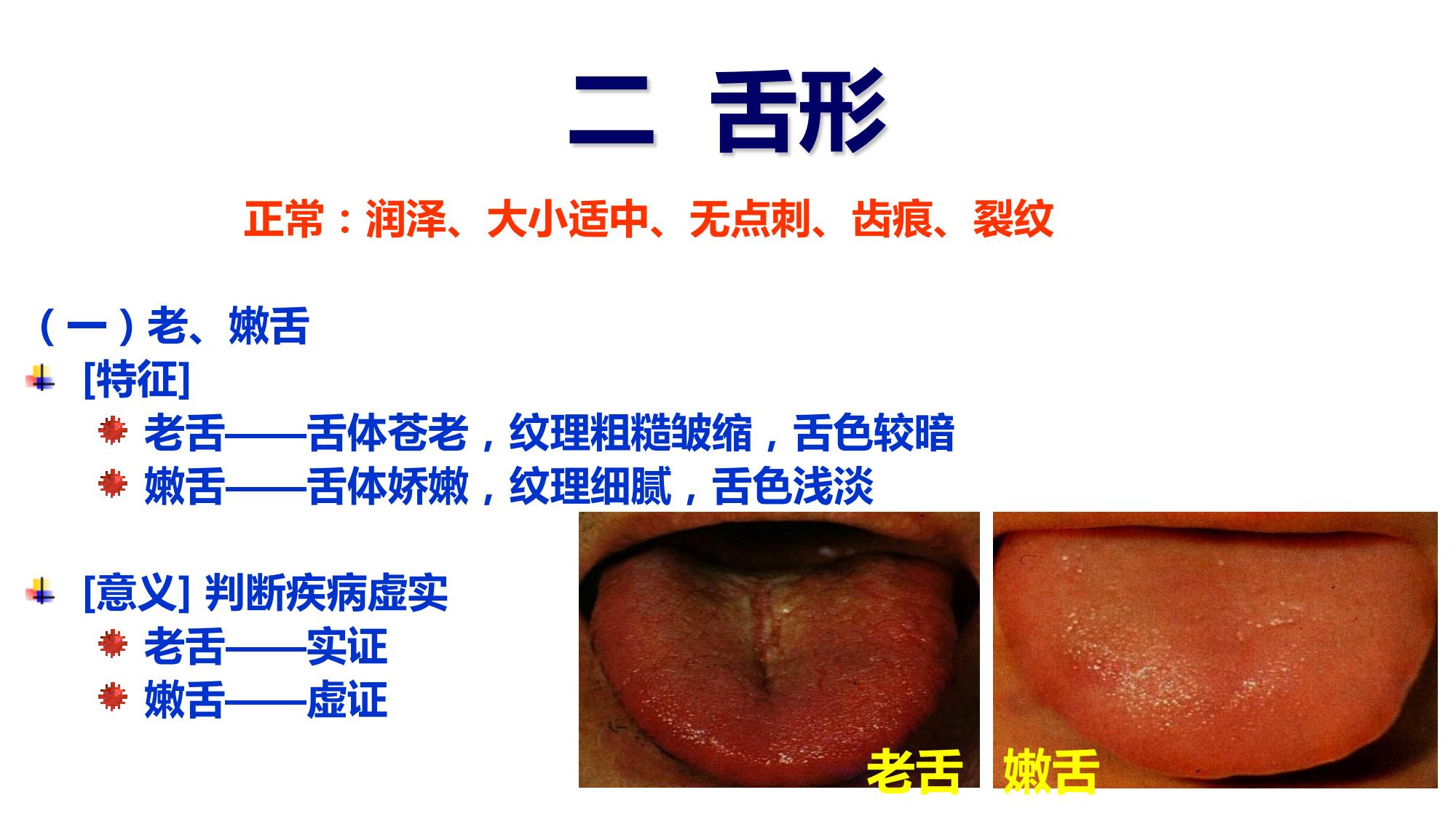 二股舌 | 舌 2つに分かれてる – VBSAL