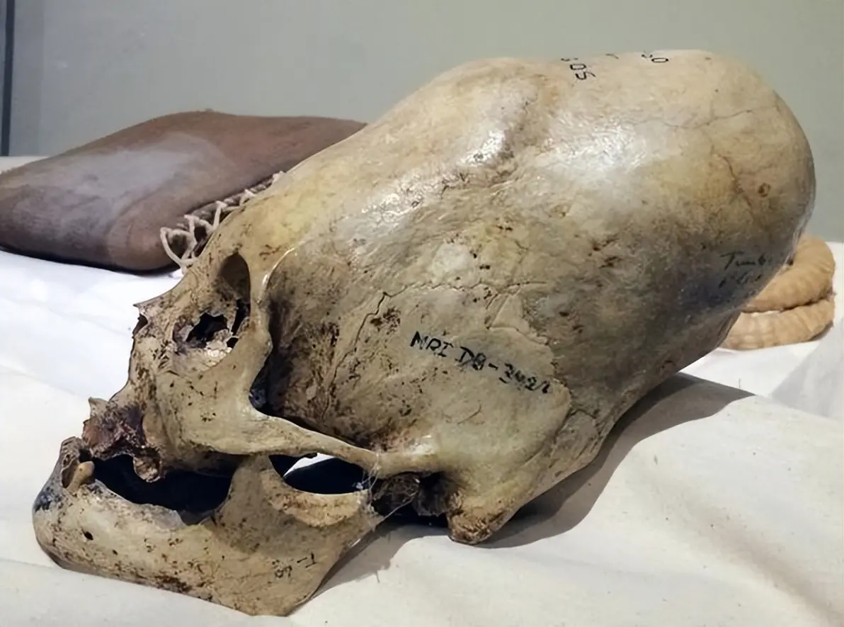 帕拉卡斯头骨来源成谜,基因检测,竟是外来物种?