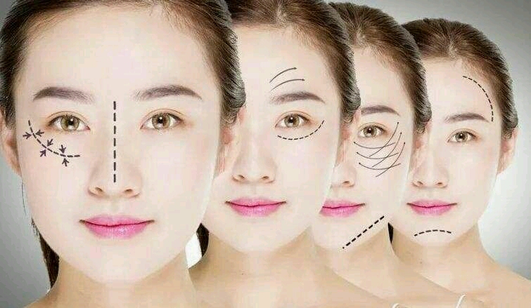 线雕多长时间做一次,线雕多久可以恢复自然小可爱的福音