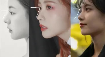 隆鼻功课 标准山根长什么样 哔哩哔哩