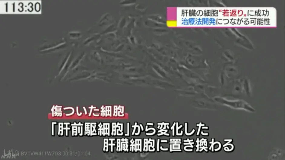 工作细胞black肝细胞介绍 哔哩哔哩