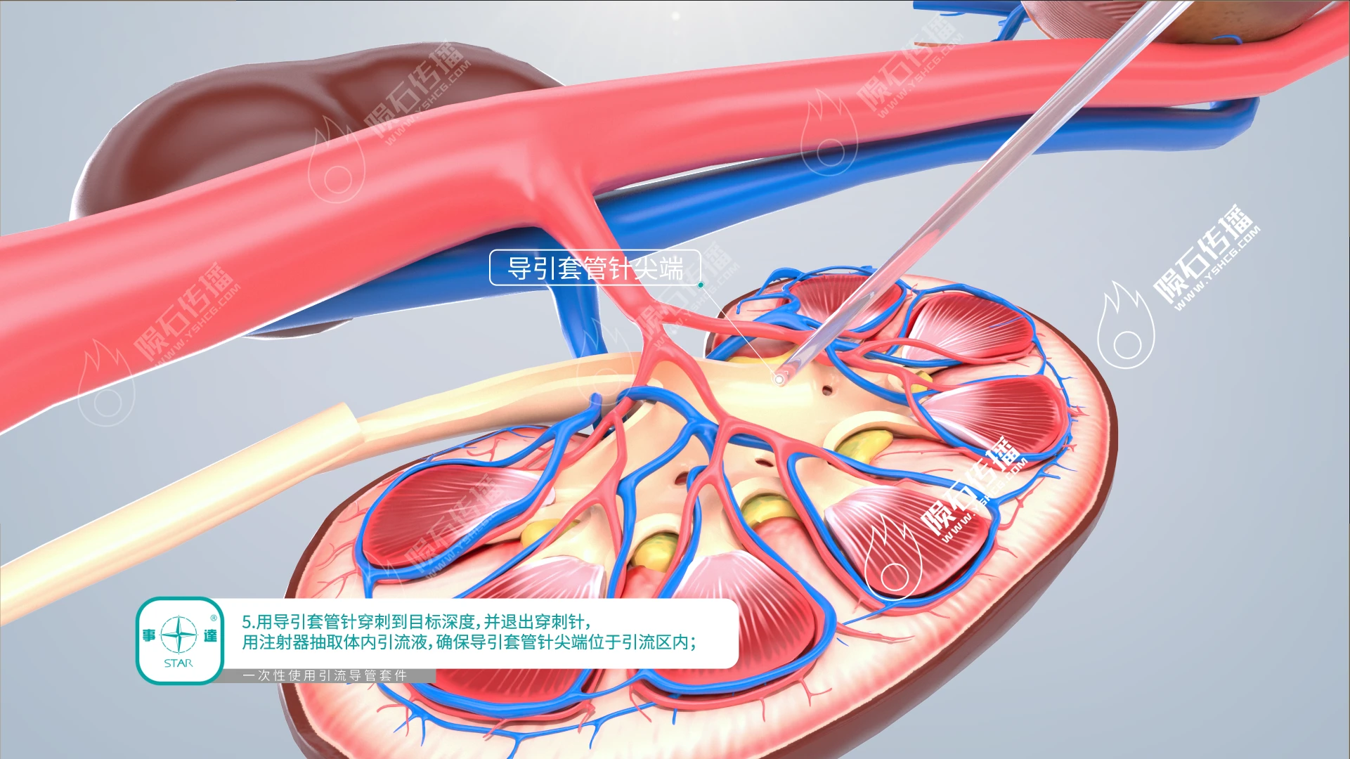 医疗动画对学术展示太重要了