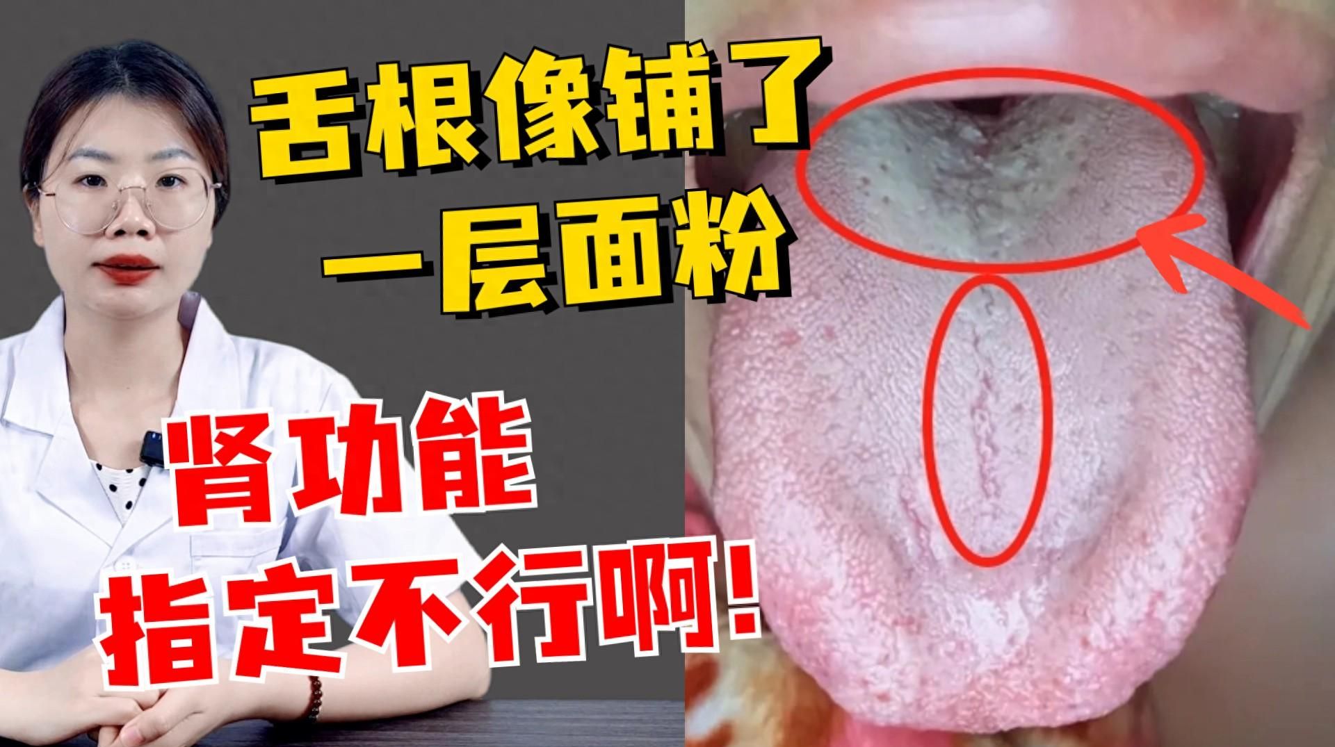 女子做核酸检测，意外发现舌部肿块…医生：这癌恶性程度高、生长快|舌癌|口腔癌|唐琦_新浪新闻