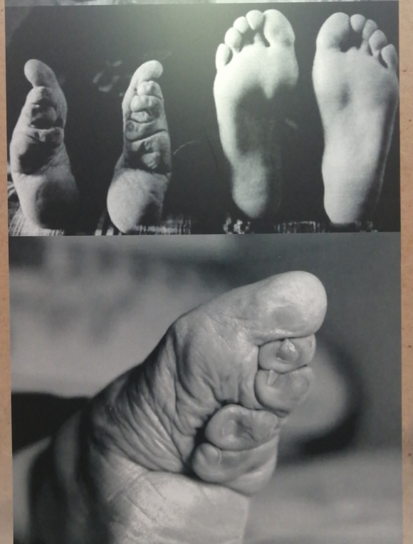 步步生莲三寸金莲文化专题收藏展览