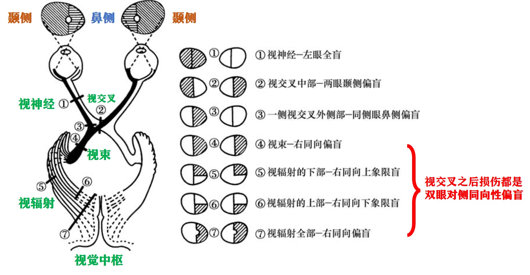 内科学-神经内科-神经系统疾病定位诊断 - 哔哩哔哩