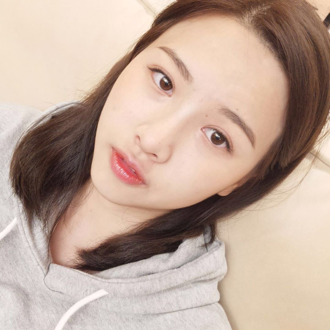 韩式无痕双眼皮拆线时间这是2020年最新技术:这种做双眼皮方式不需要