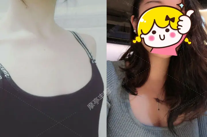 纯天然丰胸产品排行榜 纯干货分享 小本本准备好 哔哩哔哩