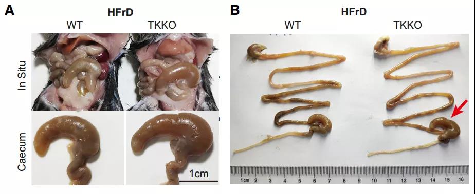 清华大学科学家发现果糖代谢速率比葡萄糖高得多而且