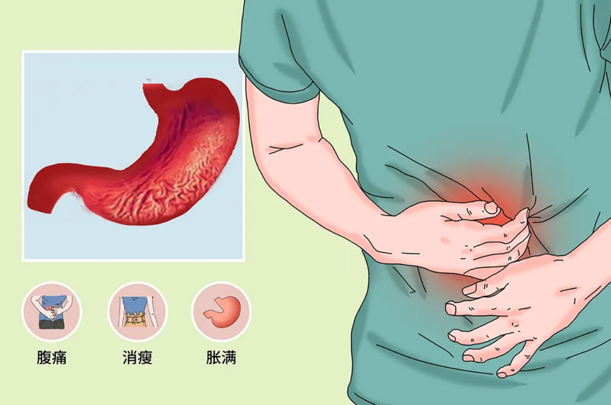 图5-10 胃的黏膜-腹部外科临床解剖学-医学