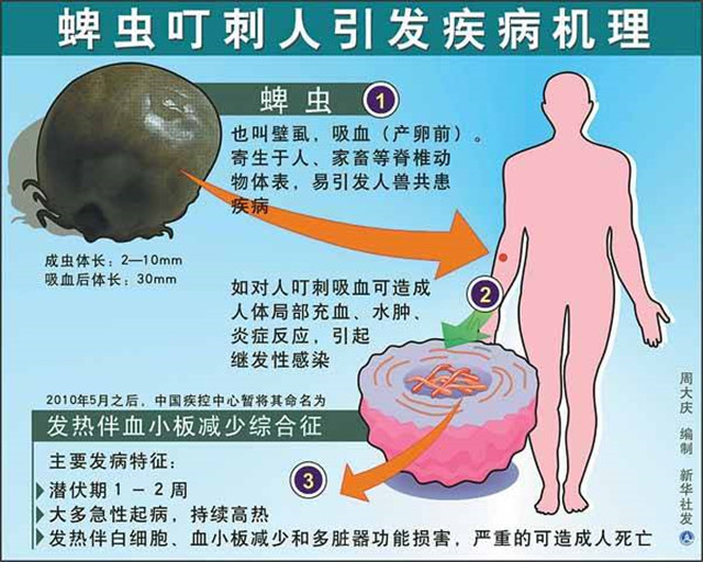 虫子虽小,但能要人命!