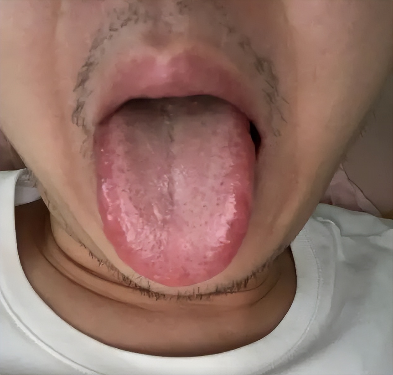 舌红少苔-京东健康