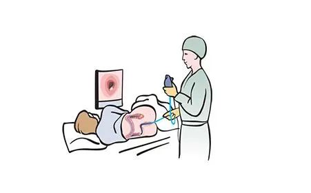 肛门疼痛——电子肛肠镜检查.