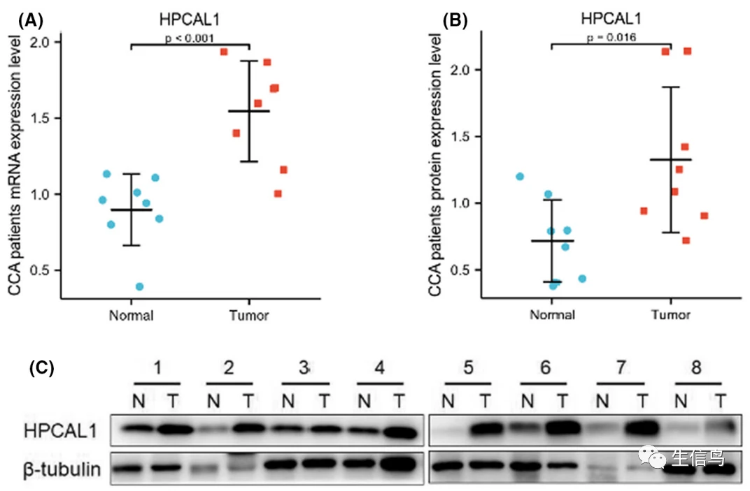 单基因分析＋免疫组化分析＋简单实验就可以轻松搞定4分+肿瘤生信文章！！快码住~ - 哔哩哔哩