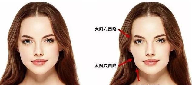 2,在牙齿矫治期间,可以刻意进行咀嚼肌的训练,例如可以嚼口香糖来