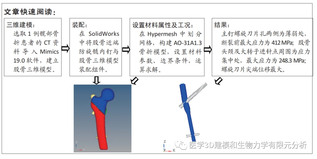 股骨近端防旋髓内钉治疗股骨转子间骨折主钉断钉失效:有限元仿真模型构建及有效性验证 - 哔哩哔哩