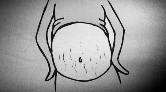 有没有祛除妊娠纹的方法?让你跟妊娠纹说拜拜