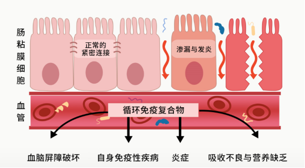 生活 日常 敏感肌的分析与护理4,肠道的强大的屏障作用    肠道里面的