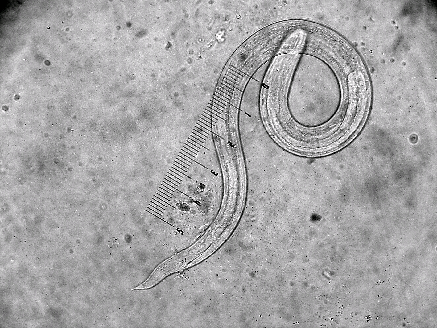介绍:这种寄生虫是在人们粗心情况下没有注意到个人卫生而产生的,大
