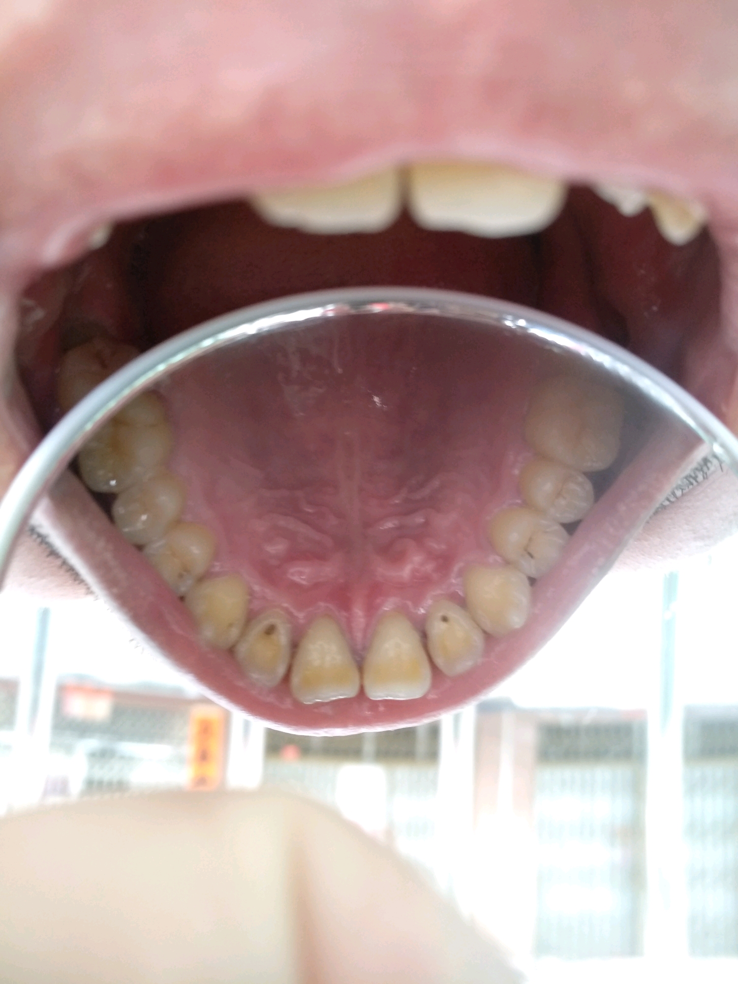 医学口腔牙科病例展示ppt模板下载-PPT家园