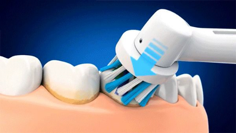 dab1a4876c9eb0087a1a5fa7da63825bcd34daaf.png