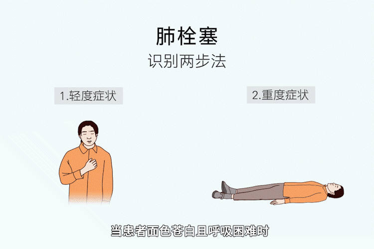 肺栓塞急救法