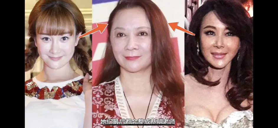 颜值分析 为什么女明星的整容归宿都是蔡明 从整容角度讲原因 唐飞飞 哔哩哔哩