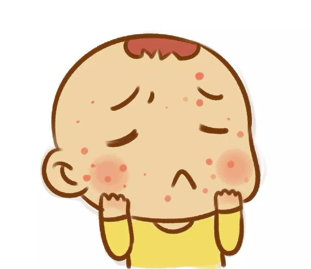 婴儿脸上干燥性湿疹怎么办（秋冬季节宝宝皮肤干燥）-幼儿百科-魔术铺