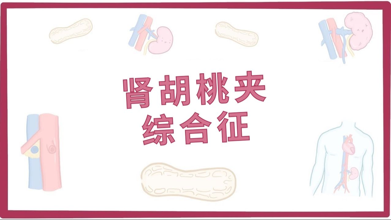 【Osmosis医学】肾胡桃夹综合征 Nutcracker Syndrome 哔哩哔哩