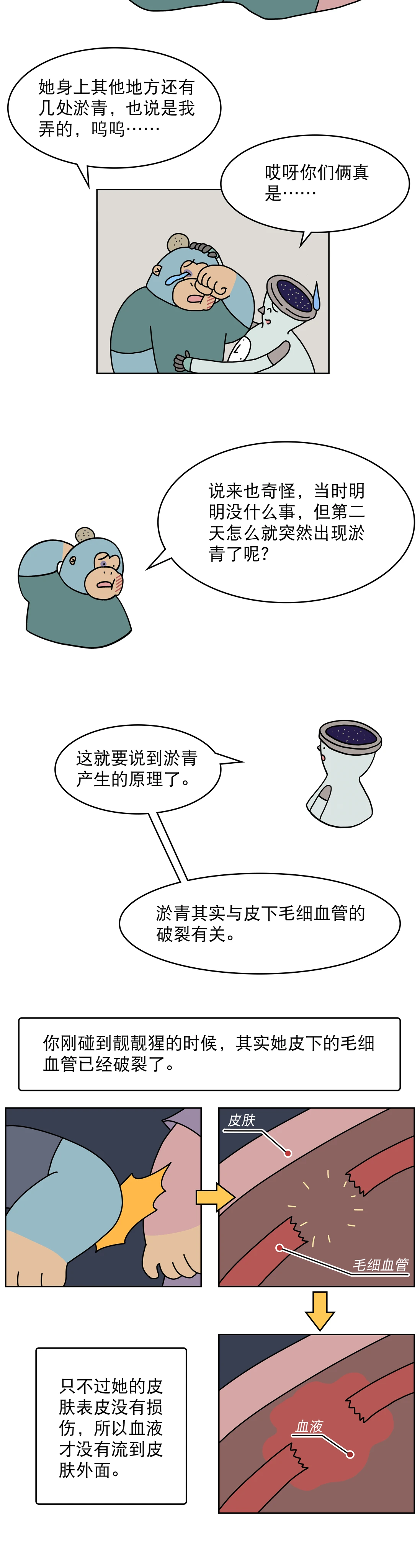身上莫名其妙的淤青都是哪来的2