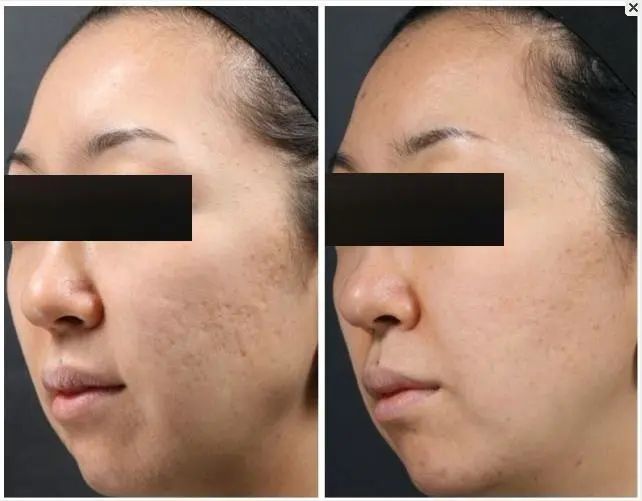 到底谁才是"磨皮美颜界"的扛把子?