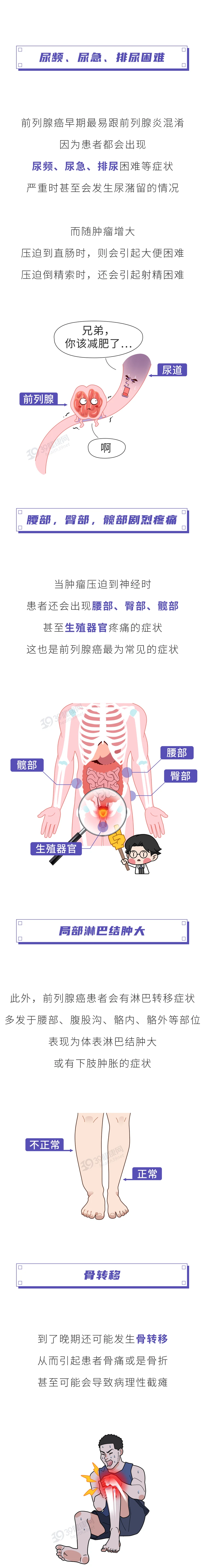 前列腺癌一发现就是晚期2