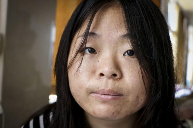 河南一24岁女孩患重症15年,期间父母相继离世,如今病房里只剩她