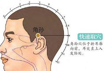 腮腺炎可以用艾灸调理吗?腮腺炎艾灸穴位