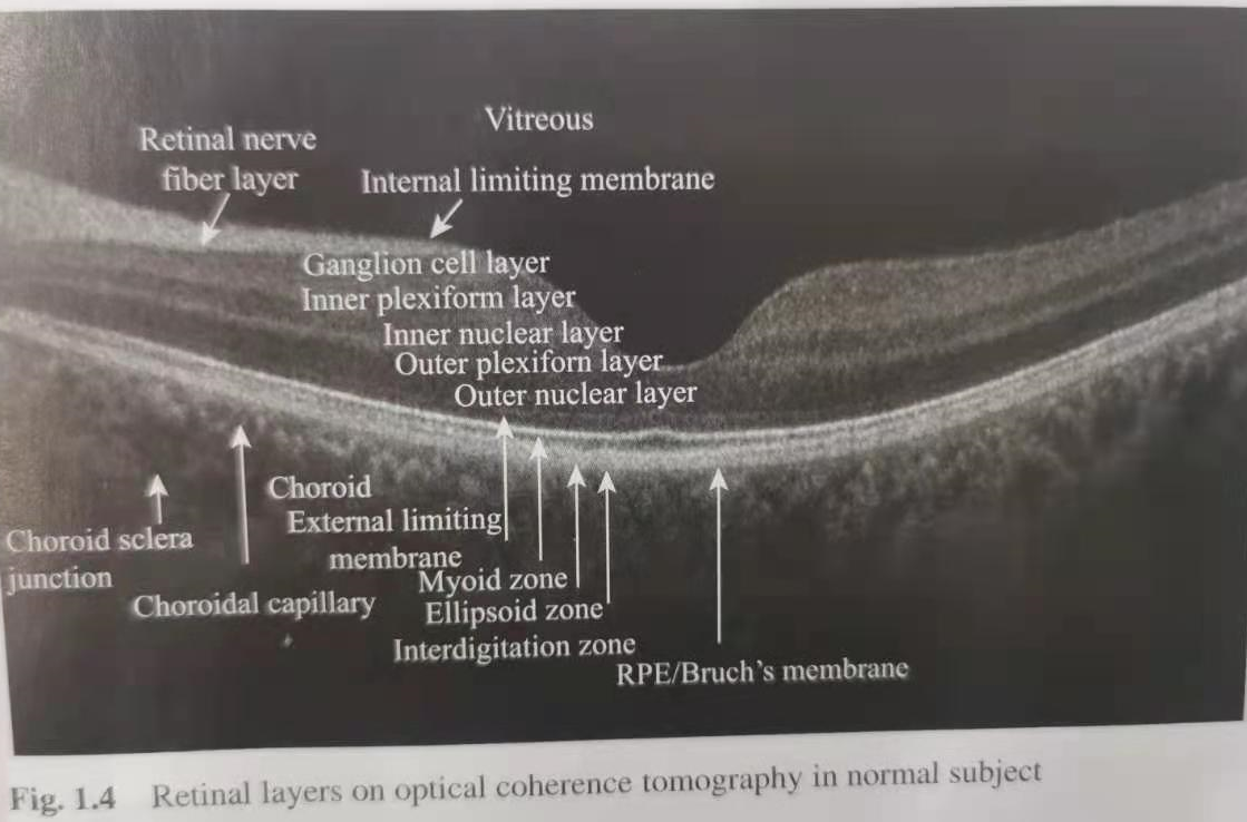 视网膜oct的详细图解图片